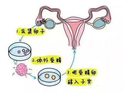 代生供卵(代生供卵：新生命的希望)