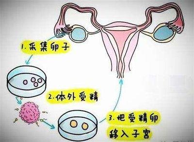 借卵是自己的孩子吗_借卵生育的孩子,是否算是自己的孩子?